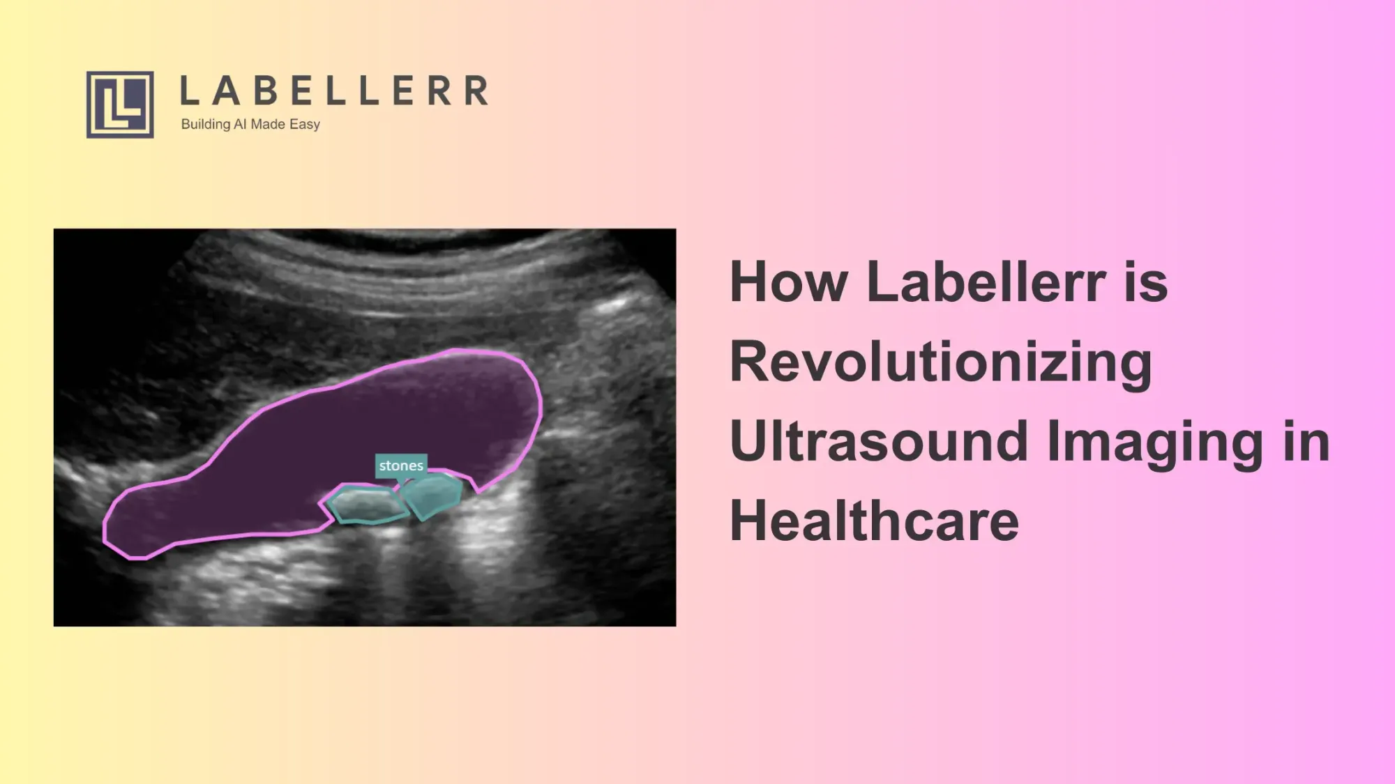 Accelerate Ultrasound Imaging Annotation With Labellerr
