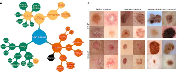 Detecting Skin Cancer Using Convolutional Neural Networks