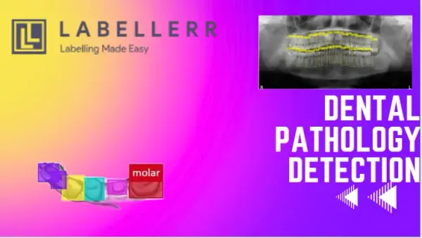 Automate Dental Image Annotation With Labellerr