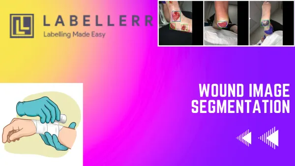 Enhancing Wound Image Segmentation with Labellerr